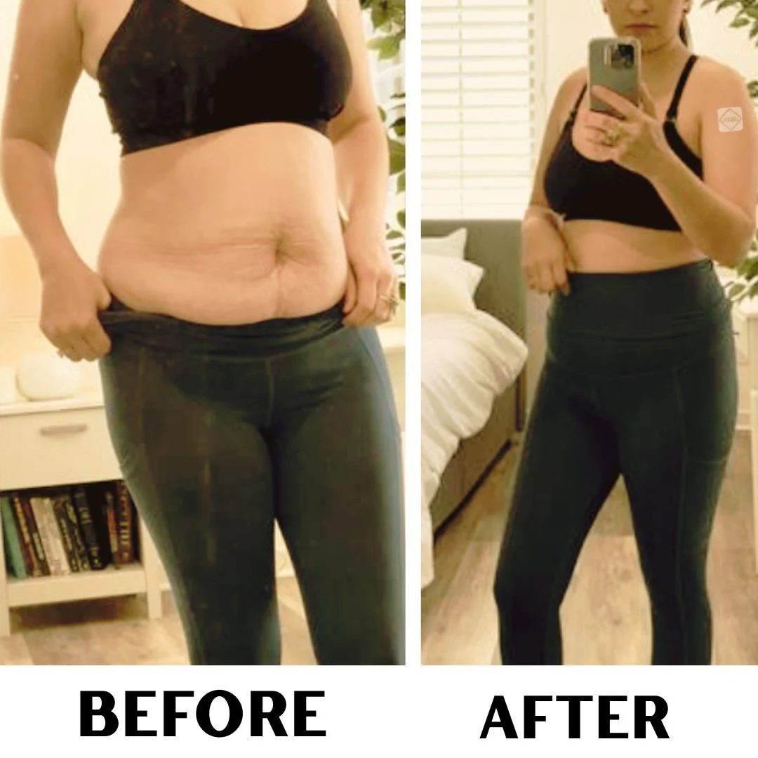 Customer before and after using TrimPure Gold Patch — visible body composition improvement